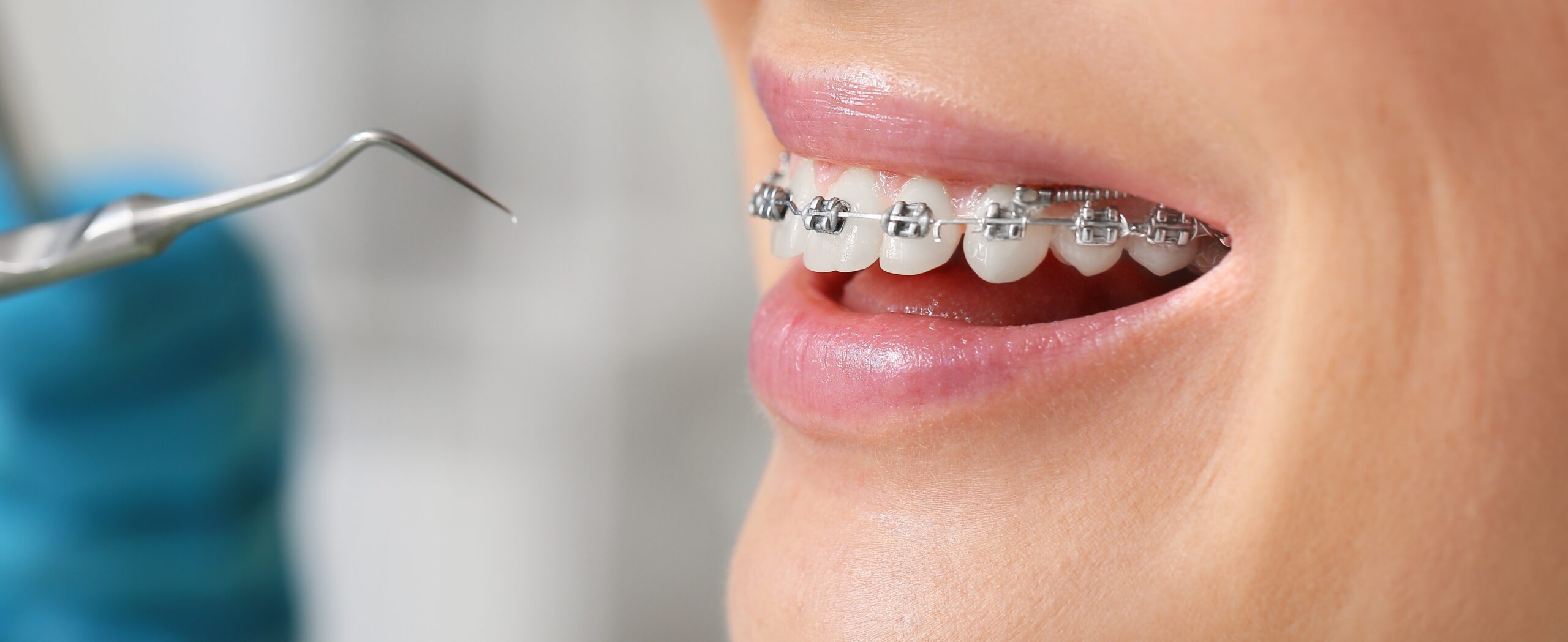 Celebrate Every Smile Milestone: Making Orthodontic Treatment Fun for Your Child