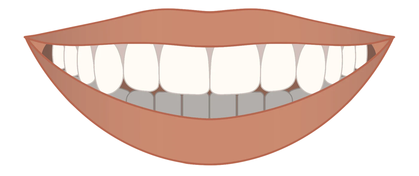 Illustration of a flat smile: the edges of the upper teeth form a straight line that does not follow the curve of the lower lip.