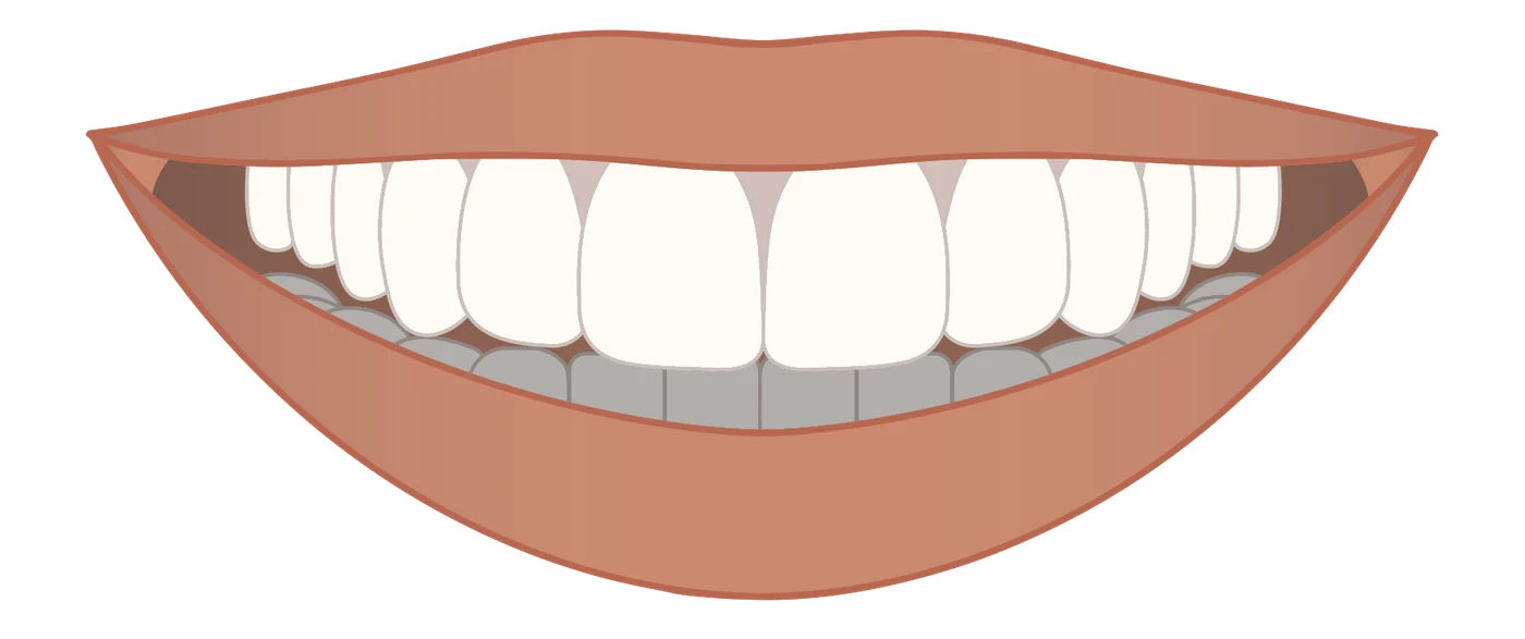 Smile Width illustration (narrow)