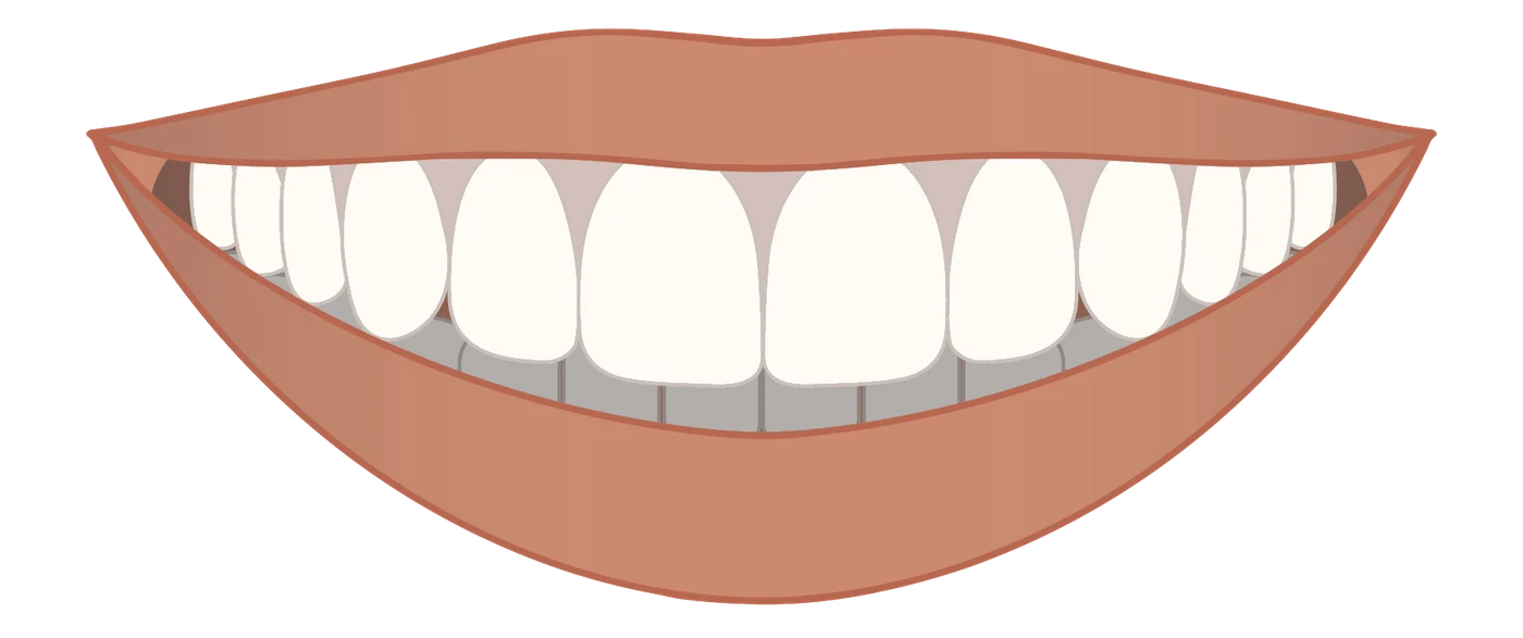 Illustration of a smile arc: the edges of the upper teeth curve upward to follow the lower lip.