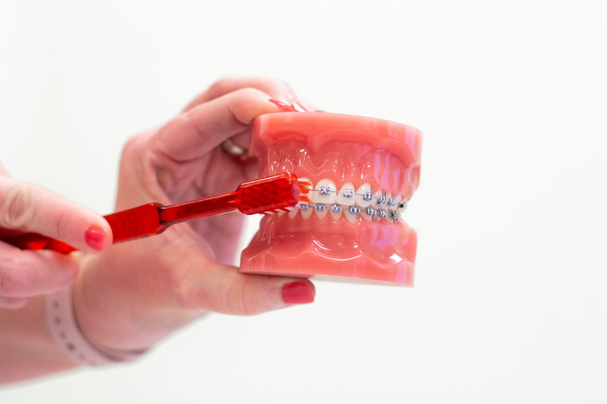 Evanston Braces