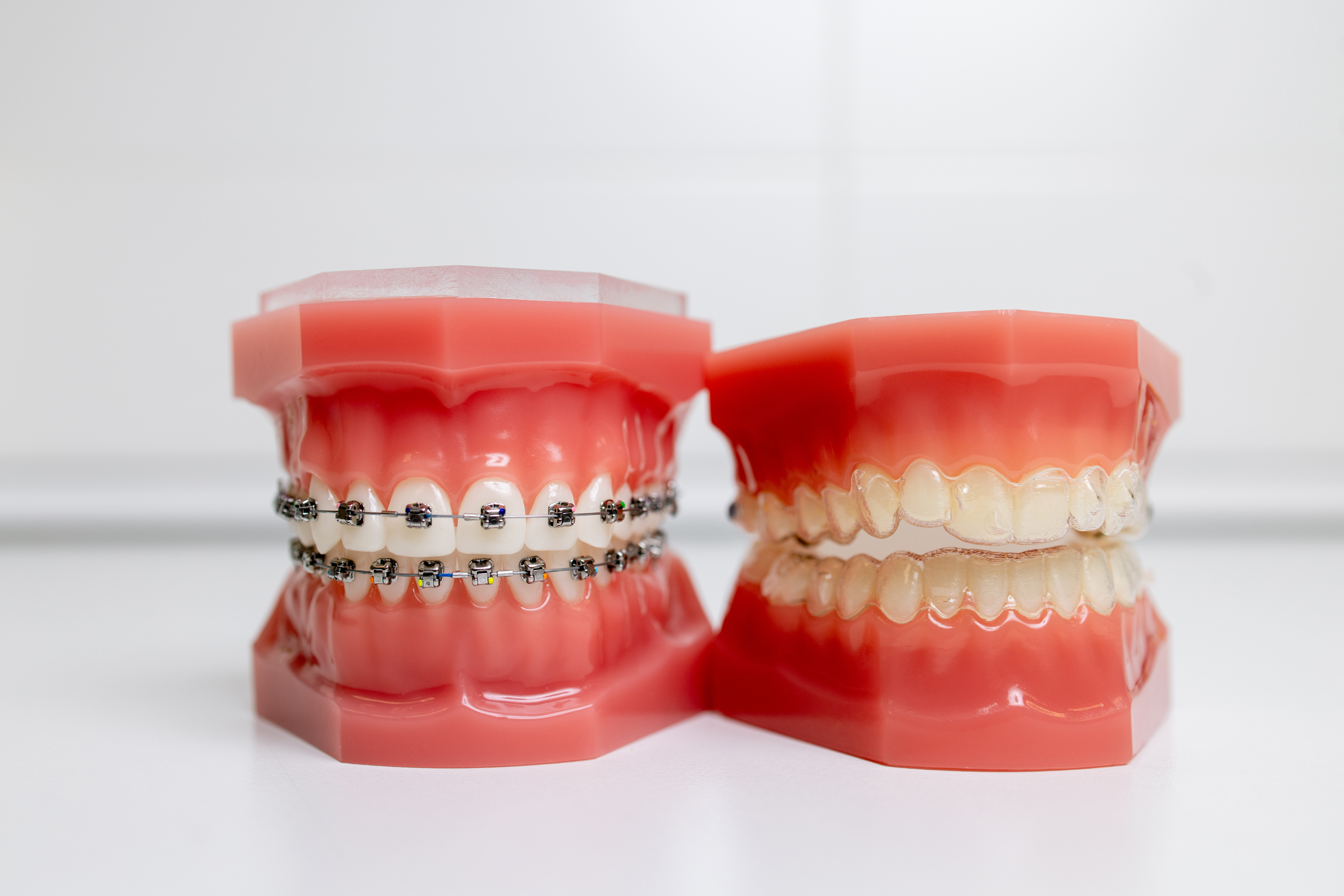 Braces vs. Invisalign: Which Option is Right for You?
